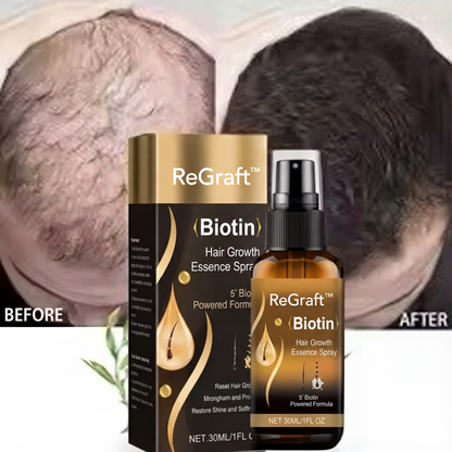 Biotin Hair Growth Spray