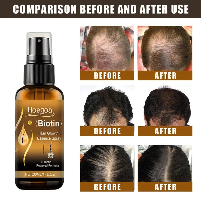 Biotin Hair Growth Spray