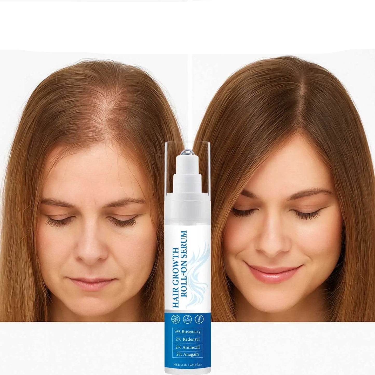 Rosemary Hair Growth Roll-On Serum